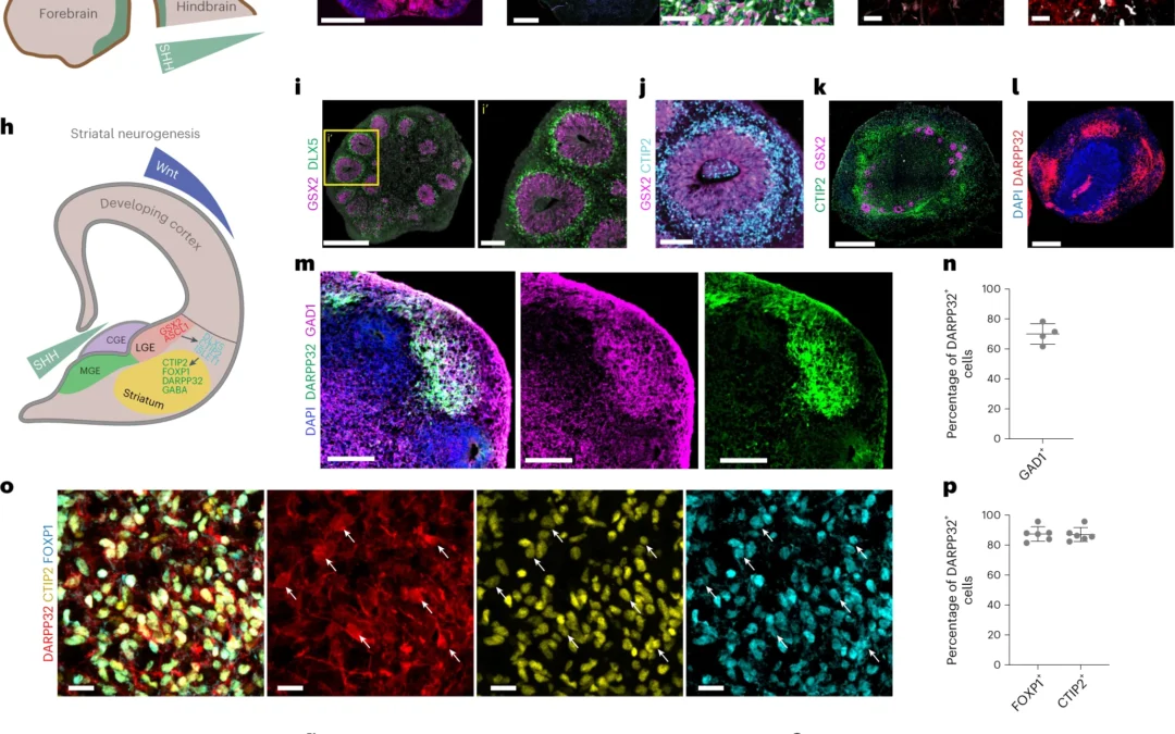 In vitro modeling of the human dopaminergic system using spatially arranged ventral midbrain–striatum–cortex assembloids
