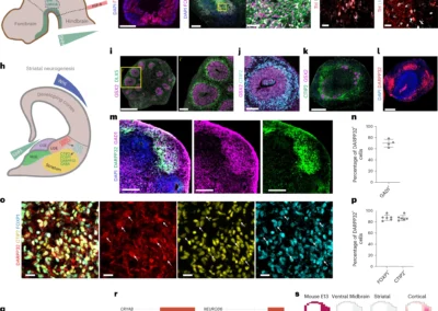 In vitro modeling of the human dopaminergic system using spatially arranged ventral midbrain–striatum–cortex assembloids