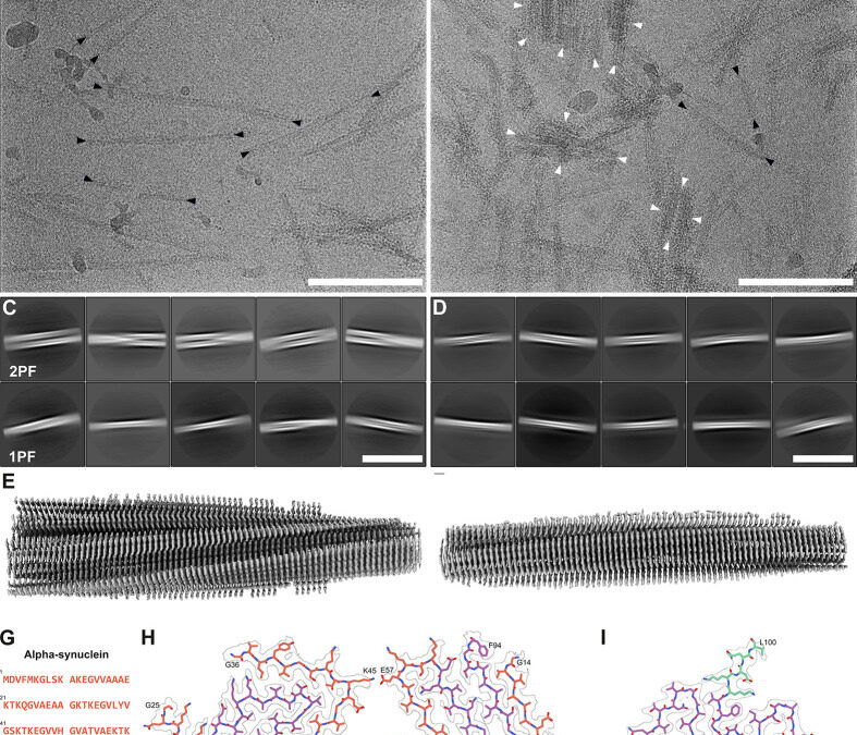 A novel alpha-synuclein G14R missense variant is associated with atypical neuropathological features